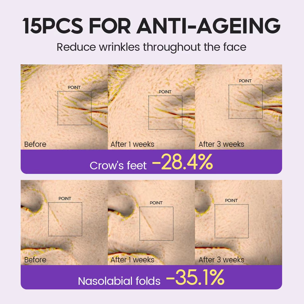 Retinol + Pro-Xylane Ampoule Serum Repairs Strengthens the Skin and Diminishes Fine Lines Face Beauty Skin Care 15Pcs
